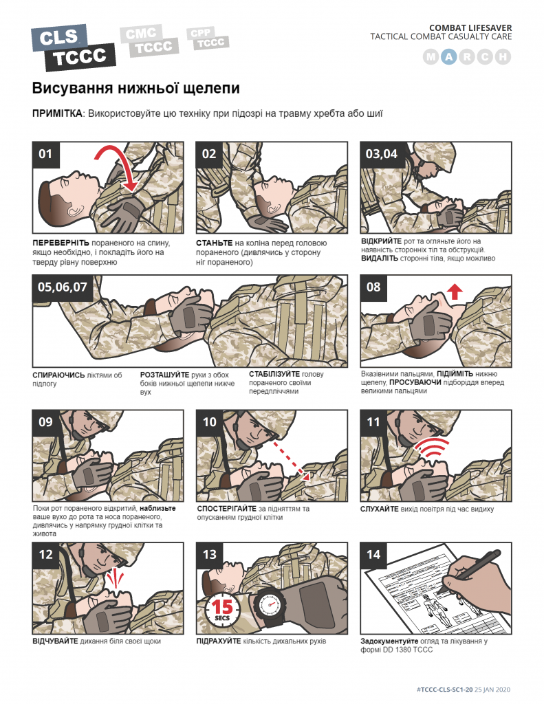 TCCC Українською Контроль дихальних шляхів та дихання - 0002