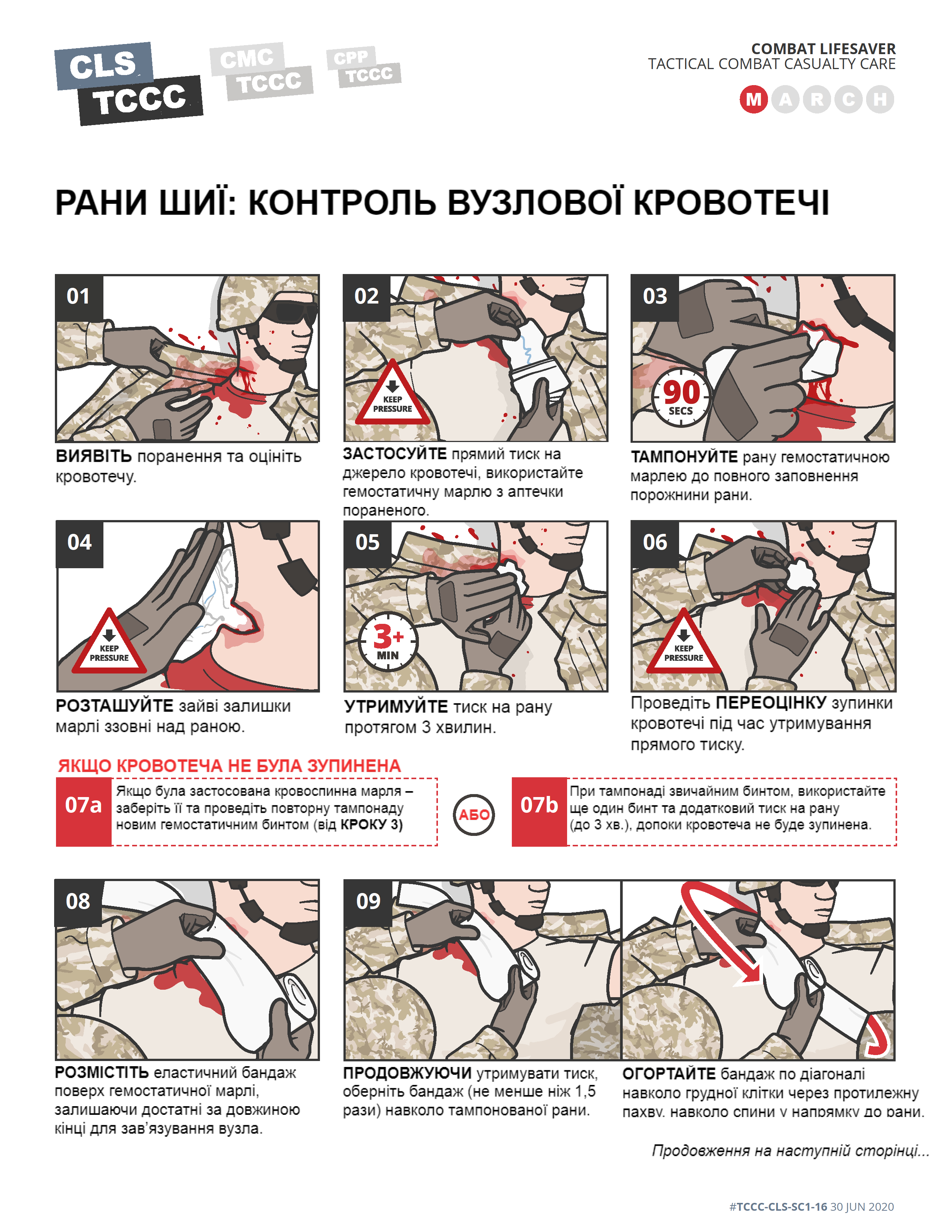 TCCC Українською Тактичне укриття контроль складних кровотеч - 0004