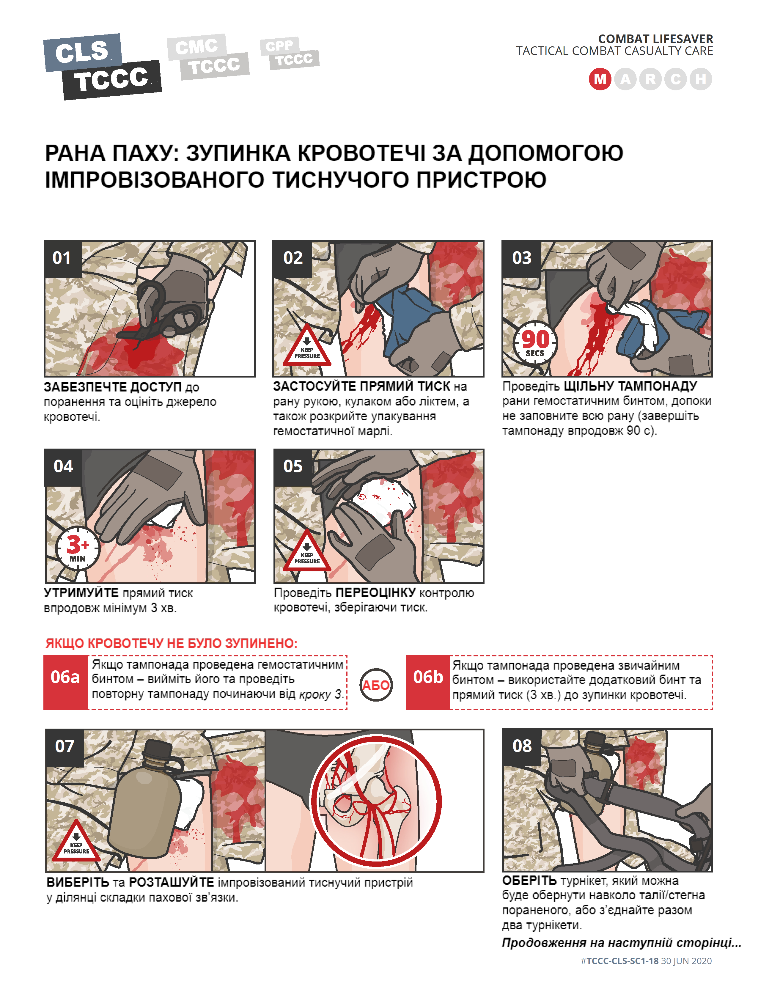 TCCC Українською Тактичне укриття контроль складних кровотеч - 0008